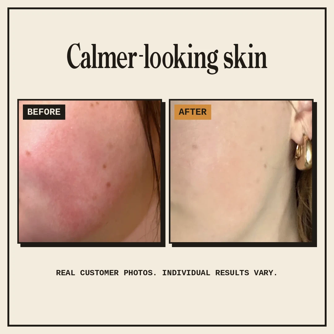 Real customer before and after photos showing calmer-looking skin