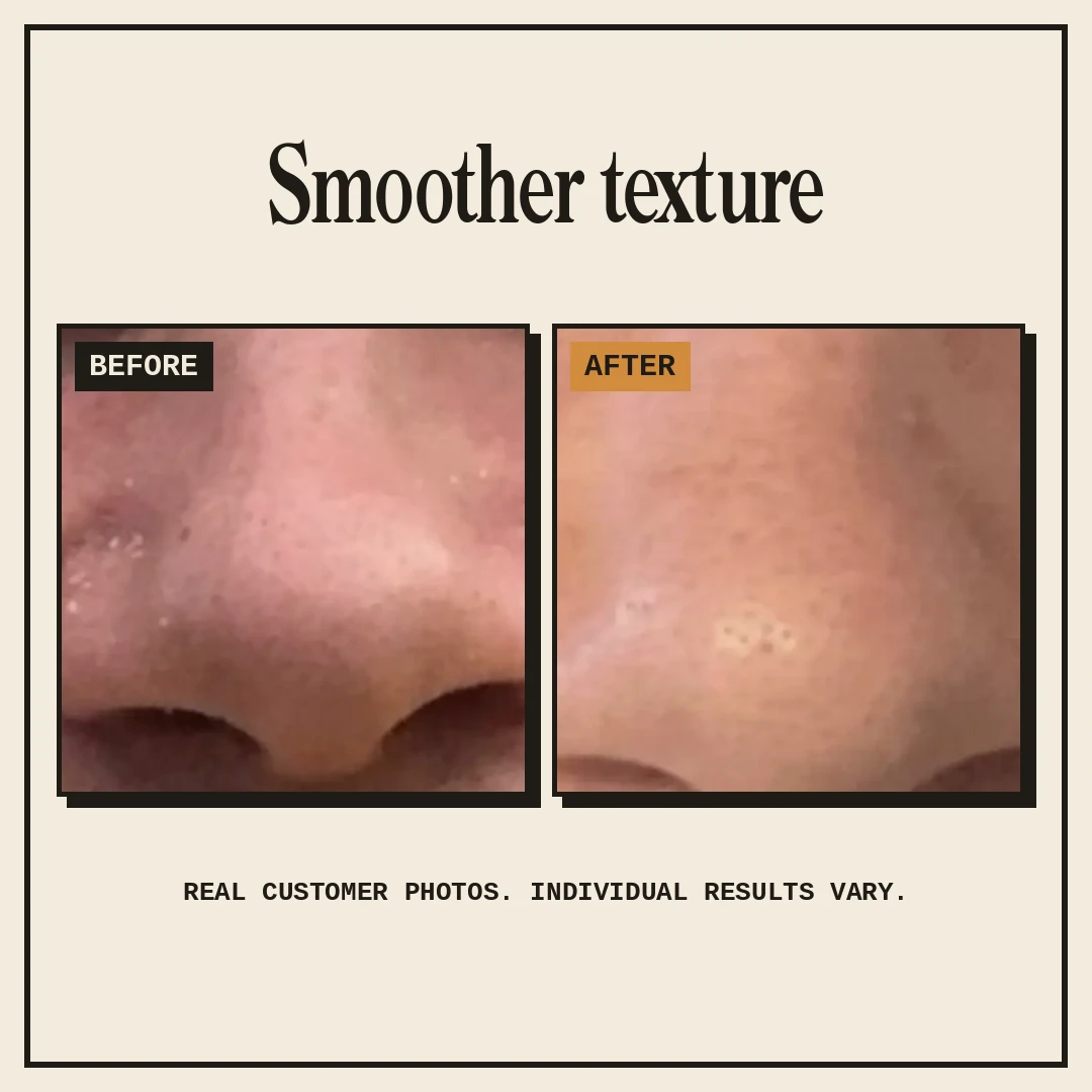 Real customer before and after photos showing smoother texture