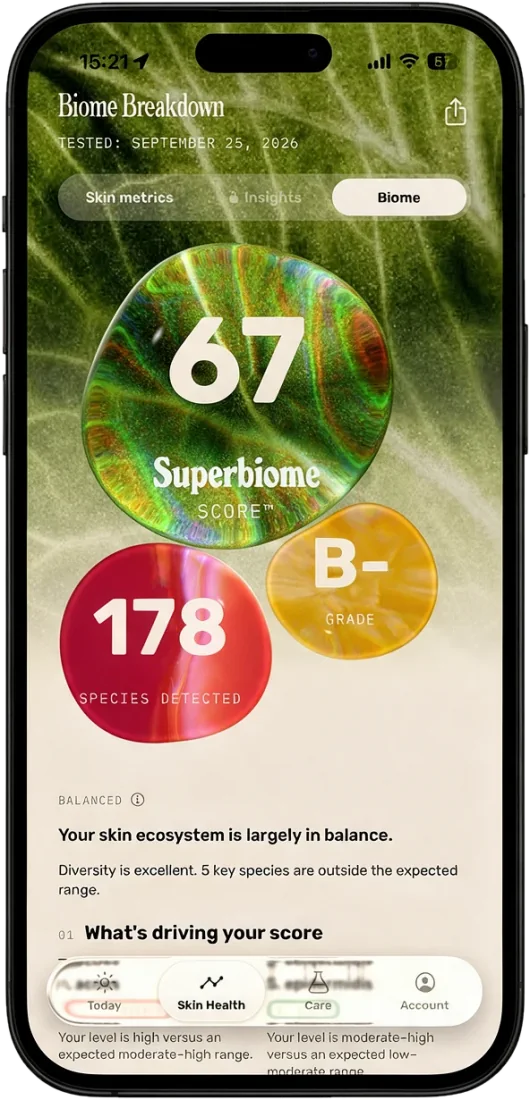 The Biome Breakdown screen: Superbiome score, species detected and grade